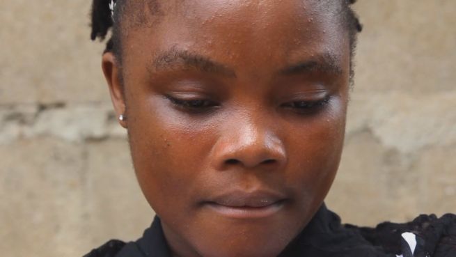 go to Überlebens-Geschichten: Diese Frau hat Ebola besiegt
